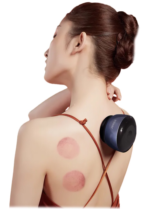 Массажер Xiaomi Youpin Zdeer (ZD-G5) Массажер